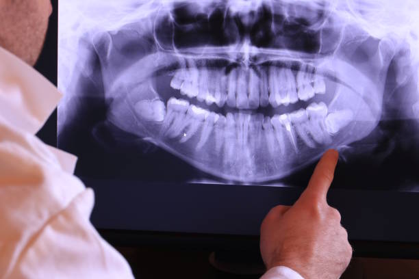 Best Emergency Tooth Extraction in Barrington, IL