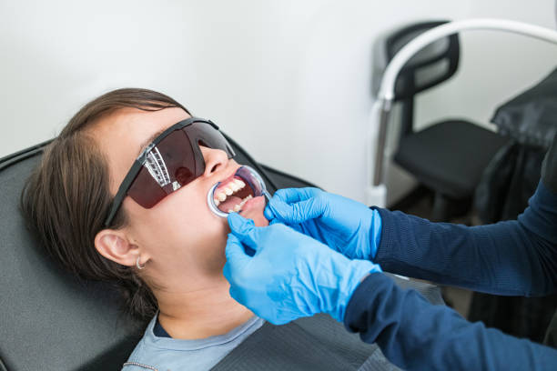 Best Emergency Wisdom Teeth Removal in Barrington, IL